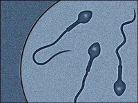 Öt év múlva segíthet a meddő párokon – Laborban állítottak elő emberi spermát 